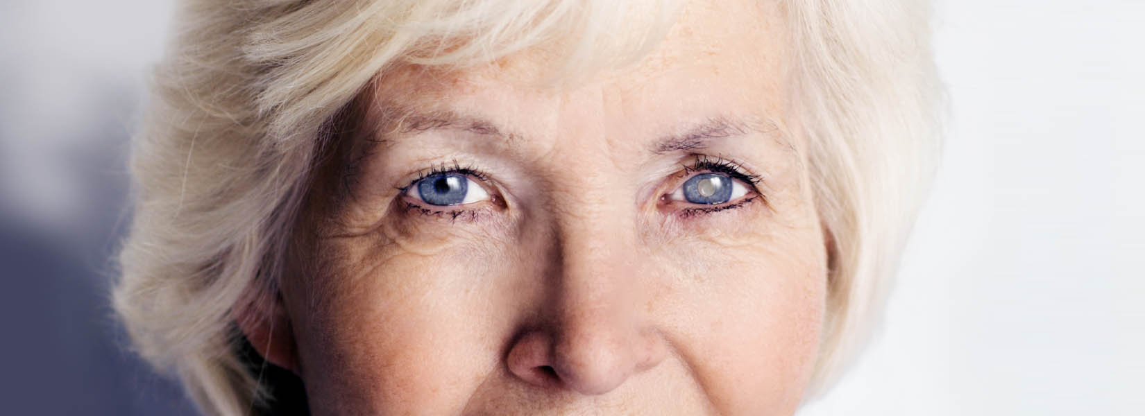 Cataract Surgery in Gallatin