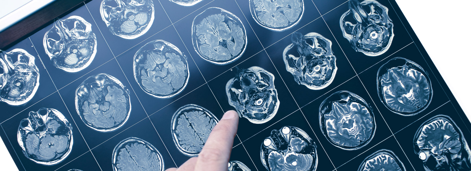 Neuro-Optometry in Gallatin